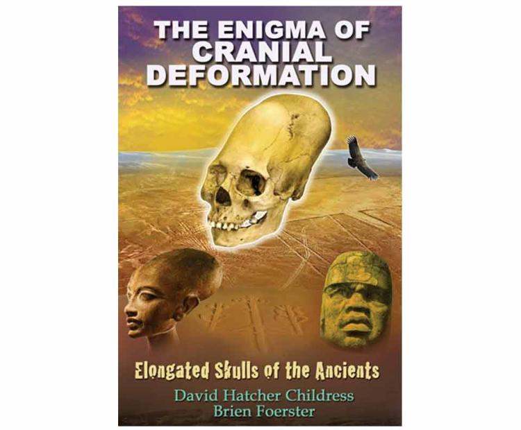 The Enigma of Cranial Deformation: Elongated Skulls of the Ancients